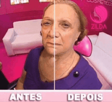 Antes Depois GIF