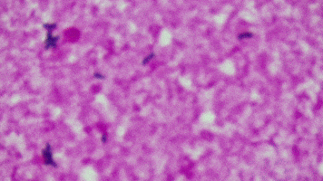 Candida Albicans GIFs - Find & Share on GIPHY