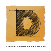 D Kapper GIF by Stichting Melanoom