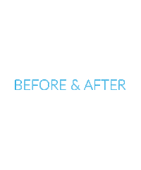 Before And After Hair Transformation Sticker by Walker Tape