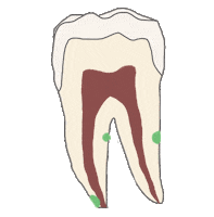 Endodoncia Sticker
