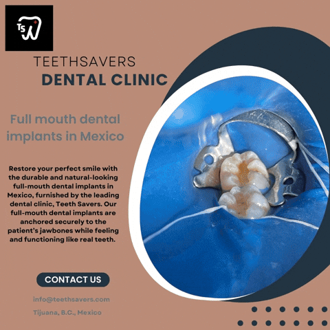 teethsaversdentalclinic giphyupload full mouth dental implants in mexico GIF