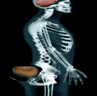 Brain Genius GIF