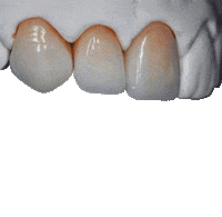 Protese Ribeiraopreto Sticker by OdontoMega