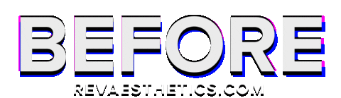 Before Sticker by REV Aesthetics