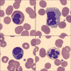 Immune System Health GIF by Ansel Oommen