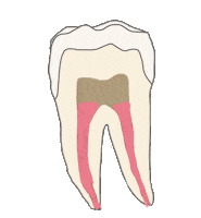 Endodoncia Sticker