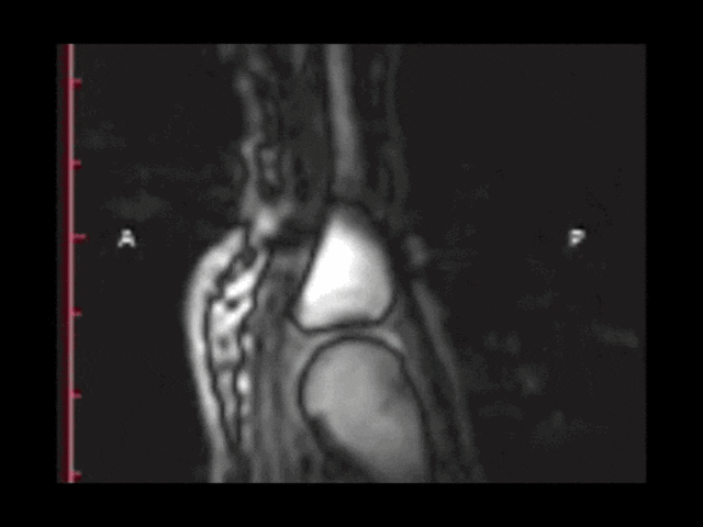crack GIF