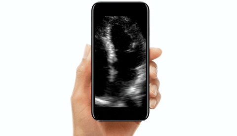 scanner ultrasound GIF by MIT