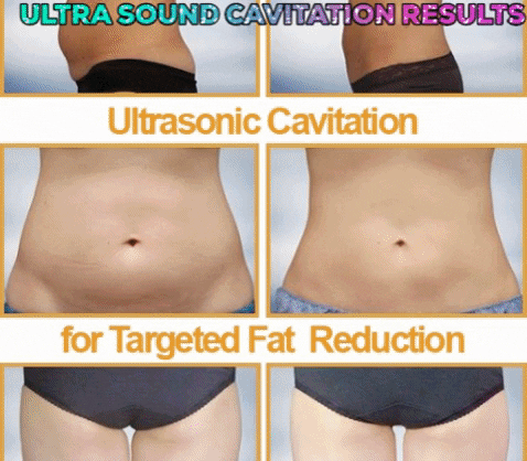 manooloo giphygifmaker GIF