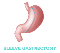 Stomach Obesity Sticker by Prof. Dr. Hasan Erdem