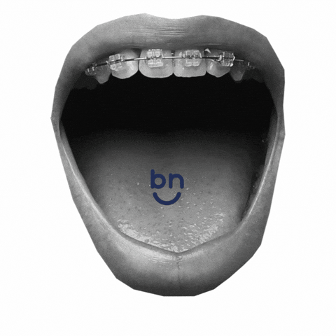 Bracesnow braces bracesnow bracesnowga GIF