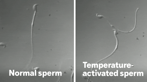 Sperm GIF