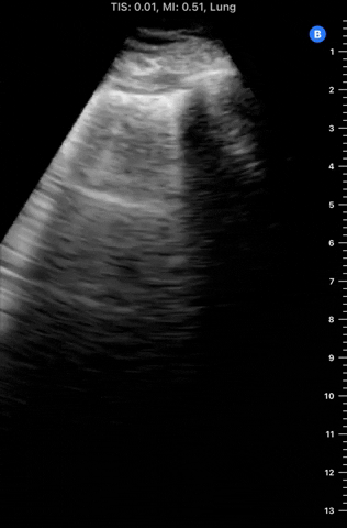PocusMed giphyupload GIF