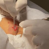 GIF by Adarsh Vijay Mudgil