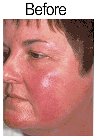 Anatomylaborg giphyupload GIF