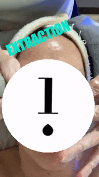 aesthetica_cosmetic_clinic hydrafacial extraction aesthetica edinburgh aesthetica cosmetic clinic GIF