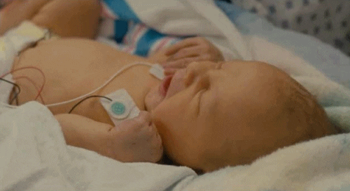 Video gif. Newborn hooked up to monitors lies on a blanket and yawns wide with eyes closed.