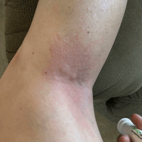 Insect Bugd GIF by Bug Bite Thing
