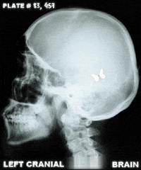 xray GIF