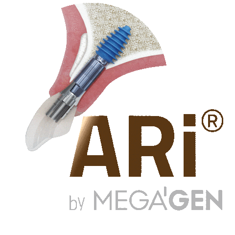 Ari Dental Implant Sticker by MegaGen Implant