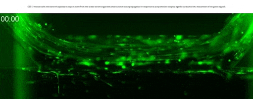 MIMETAS giphygifmaker GIF