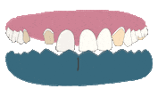 Odontoprotesis Sticker