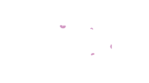Glo2Facial giphyupload geneo oxfoliation glo2facial Sticker