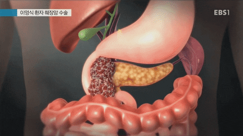 Insight_video giphyupload GIF