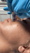 MIdStateSkinInstitute microneedling stem cells midstateskin midstateskininstitute GIF
