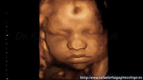 ecografie sarcina pe saptamani GIF