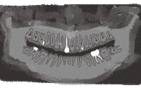 Dentist Odontologia GIF