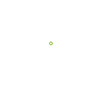 BracesOnBroad  Sticker