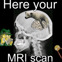 Mindfuck Are You Dumb GIF
