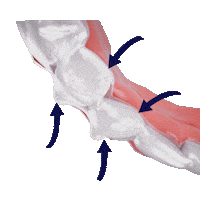 Dentist Smile Sticker by ModernClear