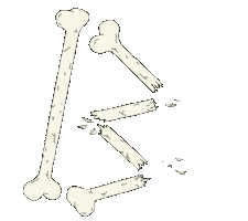 bones swinging Sticker by Peter Bjorn and John