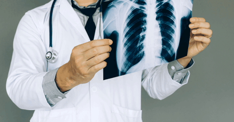 drkamranmassoumi giphygifmaker giphyattribution GIF