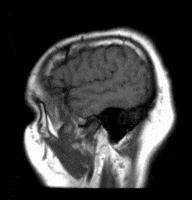 Brain Depression GIF by Sarah Walker