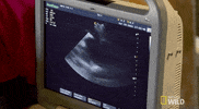 nat geo wild yukon vet GIF by Dr. Oakley, Yukon Vet