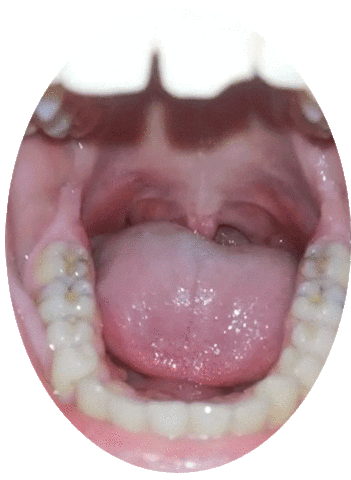 Throat Digital Health Sticker by Yesil Science AI | XR