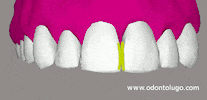 Fio Dental GIF by Dr. Raul Lugo