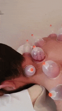 hijama  GIF