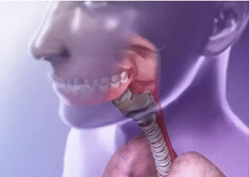 stomach GIF