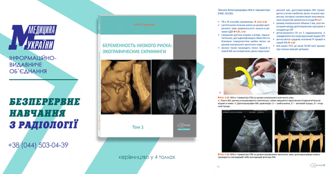 urctmrt giphyupload GIF