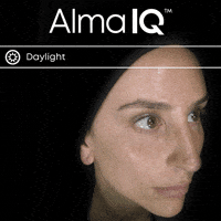 Skin Analyse GIF by Alma Lasers GmbH