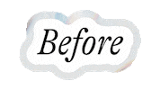 Glo2Facial before before and after geneo glo2facial Sticker