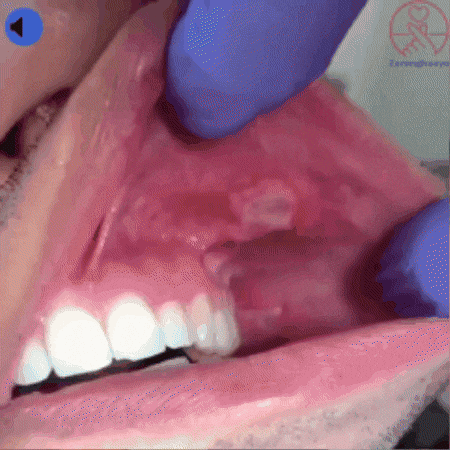 mootttt giphygifmaker GIF