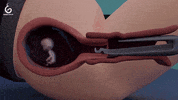 Pro-Life GIF by sundaysforlife