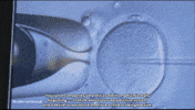 Ivf In Vitro Fertilization GIF by PBS News