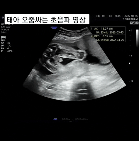 yj_jane giphyupload GIF